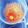 Cancer in Hindi, मेटास्टेसिस क्या है?, Types of tumer in Hindi,  ट्यूमर के प्रकार, कैंसर के कारण Causes of cancer in Hindi, Cancer class 12,  कैंसर का इलाज Treatment of cancer in hindi