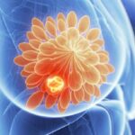 Cancer in Hindi, मेटास्टेसिस क्या है?, Types of tumer in Hindi,  ट्यूमर के प्रकार, कैंसर के कारण Causes of cancer in Hindi, Cancer class 12,  कैंसर का इलाज Treatment of cancer in hindi