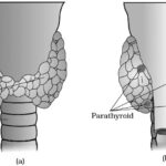 Thyroid gland hindi
